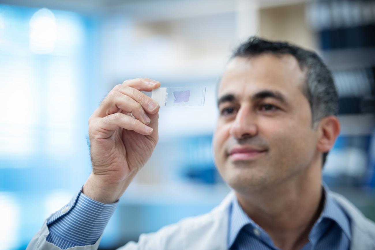 Dr. Ali Bashashati observes an endometrial cancer sample on a microscope slide. Photo courtesy of UBC Faculty of Medicine